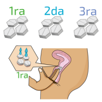 aborto-seguro-via-vaginal.png